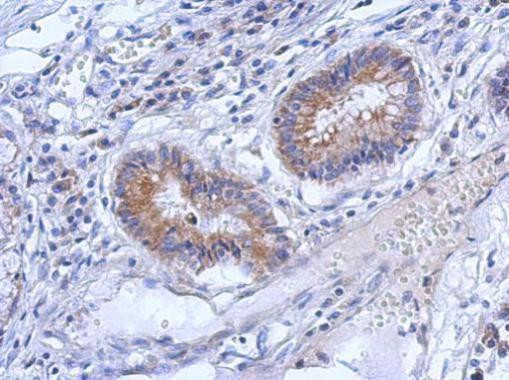 ZNF645 Antibody in Immunohistochemistry (Paraffin) (IHC (P))
