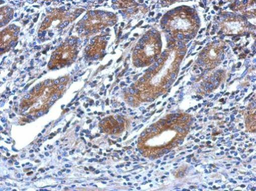 OSBP2 Antibody in Immunohistochemistry (Paraffin) (IHC (P))