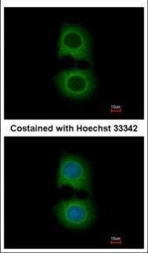 TMOD2 Antibody in Immunocytochemistry (ICC/IF)