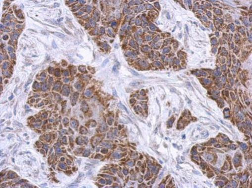 PLCL2 Antibody in Immunohistochemistry (Paraffin) (IHC (P))