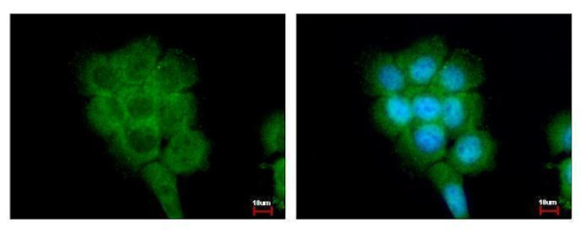 FPGT Antibody in Immunocytochemistry (ICC/IF)