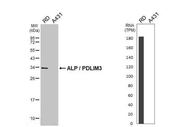 PDLIM3 Antibody in Western Blot (WB)