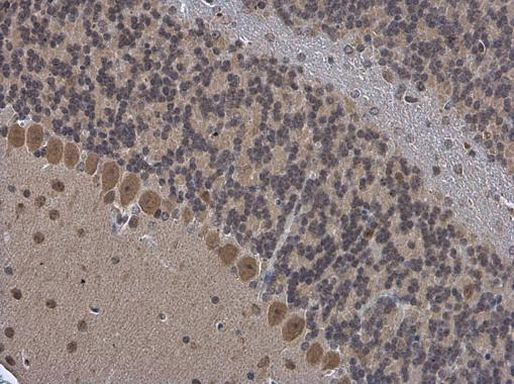 OGFOD1 Antibody in Immunohistochemistry (Paraffin) (IHC (P))