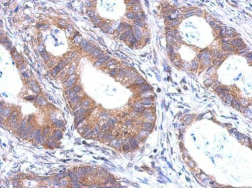 BTBD6 Antibody in Immunohistochemistry (Paraffin) (IHC (P))