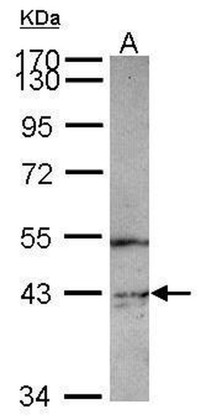 PIP4K2C Antibody in Western Blot (WB)