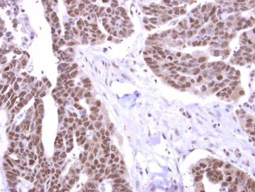 STK31 Antibody in Immunohistochemistry (Paraffin) (IHC (P))