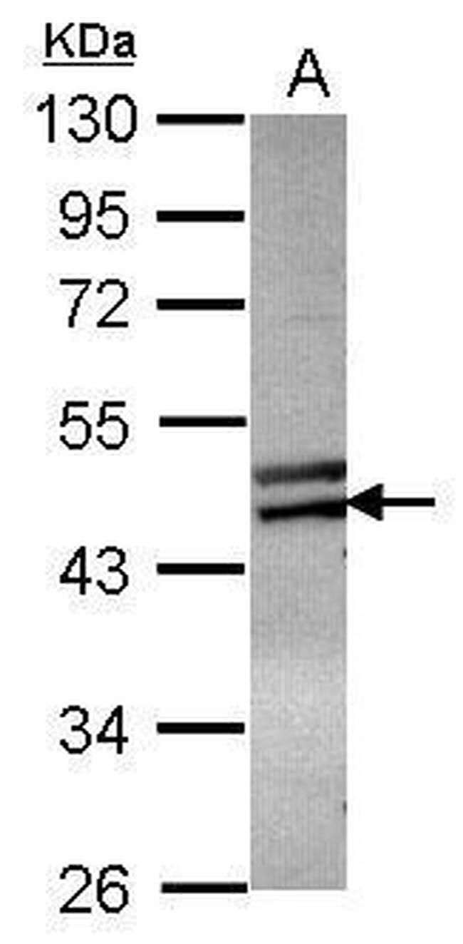 ZNF439 Antibody in Western Blot (WB)