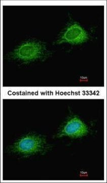 PITRM1 Antibody in Immunocytochemistry (ICC/IF)