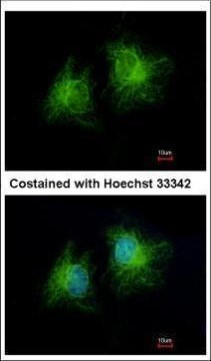 CCDC28B Antibody in Immunocytochemistry (ICC/IF)