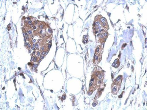 DDX59 Antibody in Immunohistochemistry (Paraffin) (IHC (P))