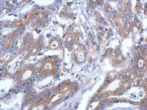 RASSF4 Antibody in Immunohistochemistry (Paraffin) (IHC (P))