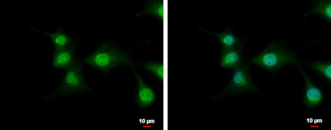 C9orf72 Antibody in Immunocytochemistry (ICC/IF)