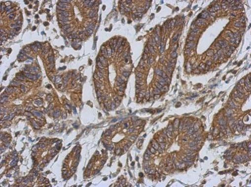 EPLIN Antibody in Immunohistochemistry (Paraffin) (IHC (P))
