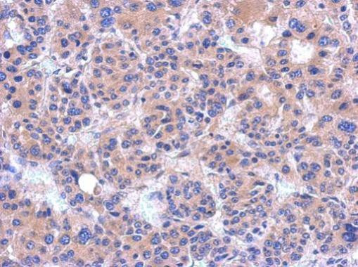 PDZRN4 Antibody in Immunohistochemistry (Paraffin) (IHC (P))