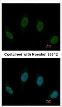 TTC40 Antibody in Immunocytochemistry (ICC/IF)