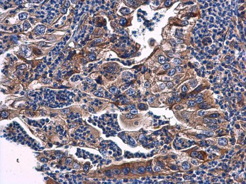 PHOSPHO2 Antibody in Immunohistochemistry (Paraffin) (IHC (P))