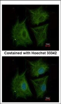 AGBL4 Antibody in Immunocytochemistry (ICC/IF)