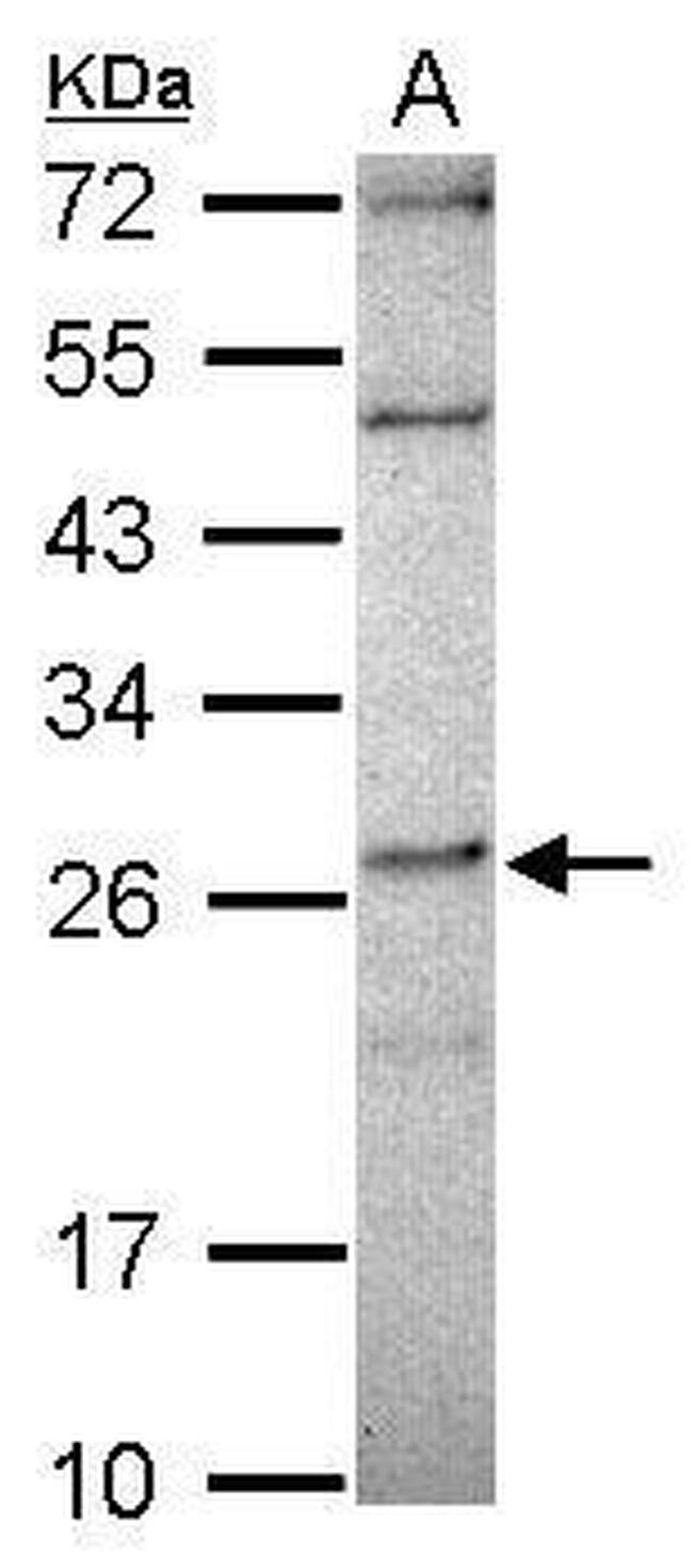 DPCD Antibody in Western Blot (WB)