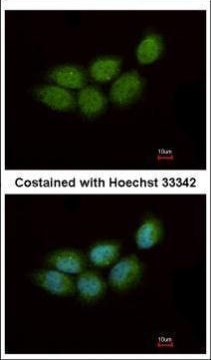 ZCCHC4 Antibody in Immunocytochemistry (ICC/IF)