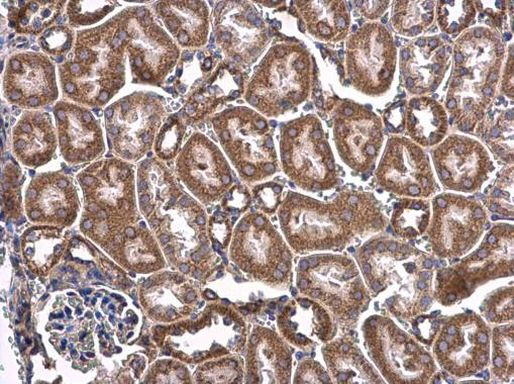 CHCHD3 Antibody in Immunohistochemistry (Paraffin) (IHC (P))