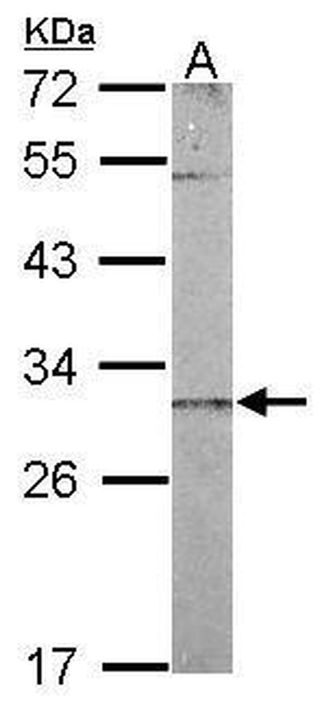 CHCHD3 Antibody in Western Blot (WB)