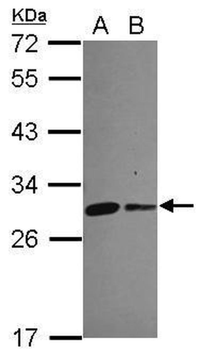 CHCHD3 Antibody in Western Blot (WB)