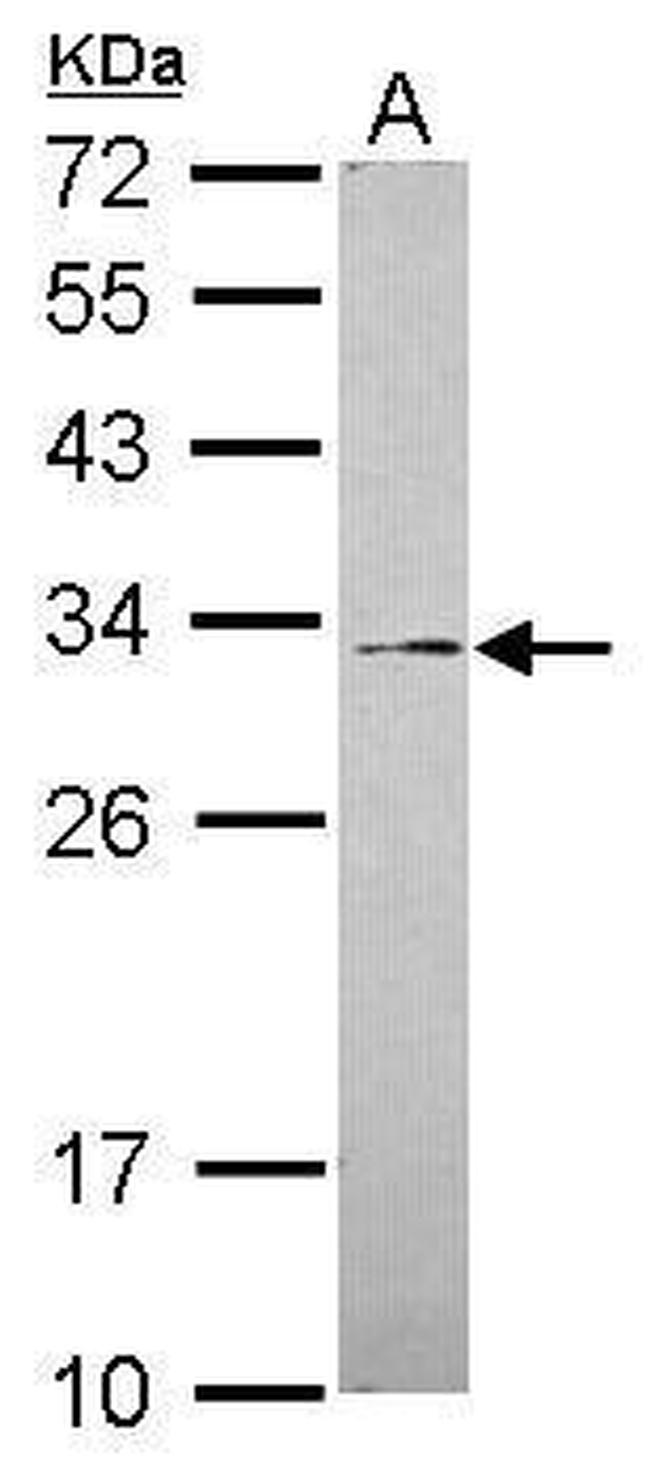 GALNT12 Antibody in Western Blot (WB)