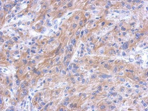 CTTNBP2NL Antibody in Immunohistochemistry (Paraffin) (IHC (P))