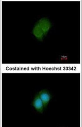 ANKS3 Antibody in Immunocytochemistry (ICC/IF)