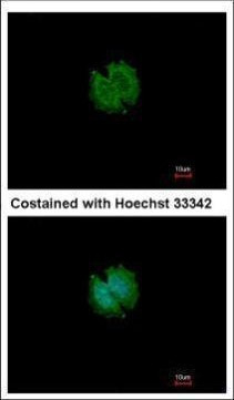 CATSPERB Antibody in Immunocytochemistry (ICC/IF)