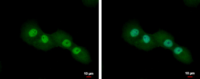 CUTC Antibody in Immunocytochemistry (ICC/IF)