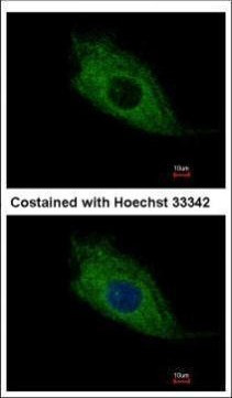 TMEM66 Antibody in Immunocytochemistry (ICC/IF)