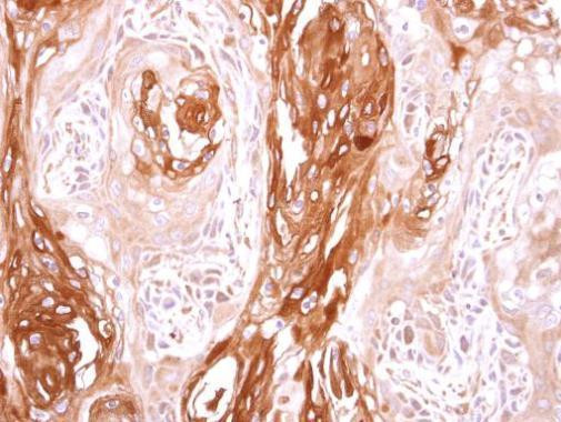 SEC23B Antibody in Immunohistochemistry (Paraffin) (IHC (P))
