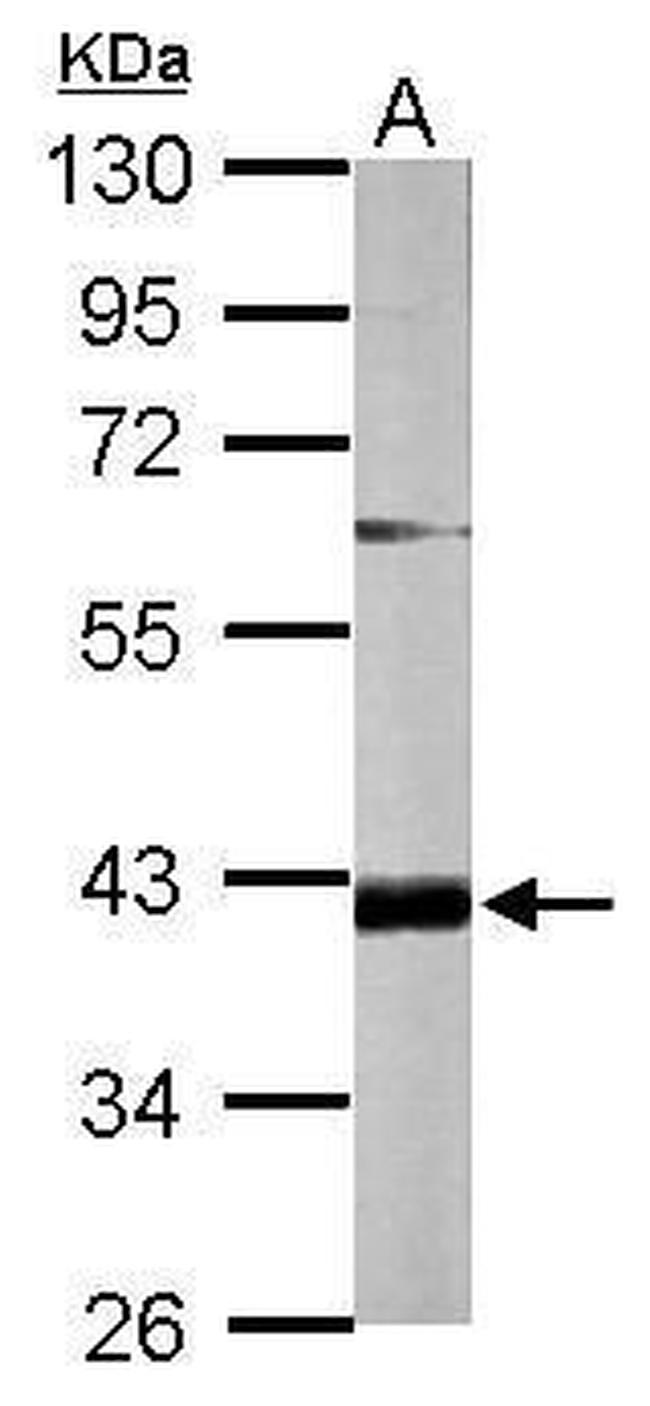 FAM46D Antibody in Western Blot (WB)