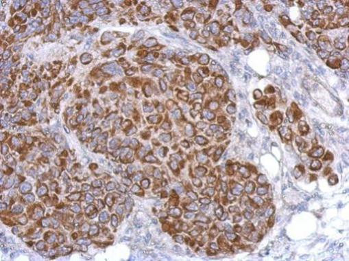ARHGAP9 Antibody in Immunohistochemistry (Paraffin) (IHC (P))