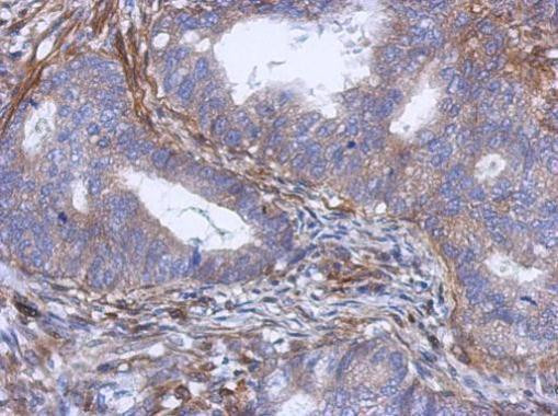 PABPC5 Antibody in Immunohistochemistry (Paraffin) (IHC (P))