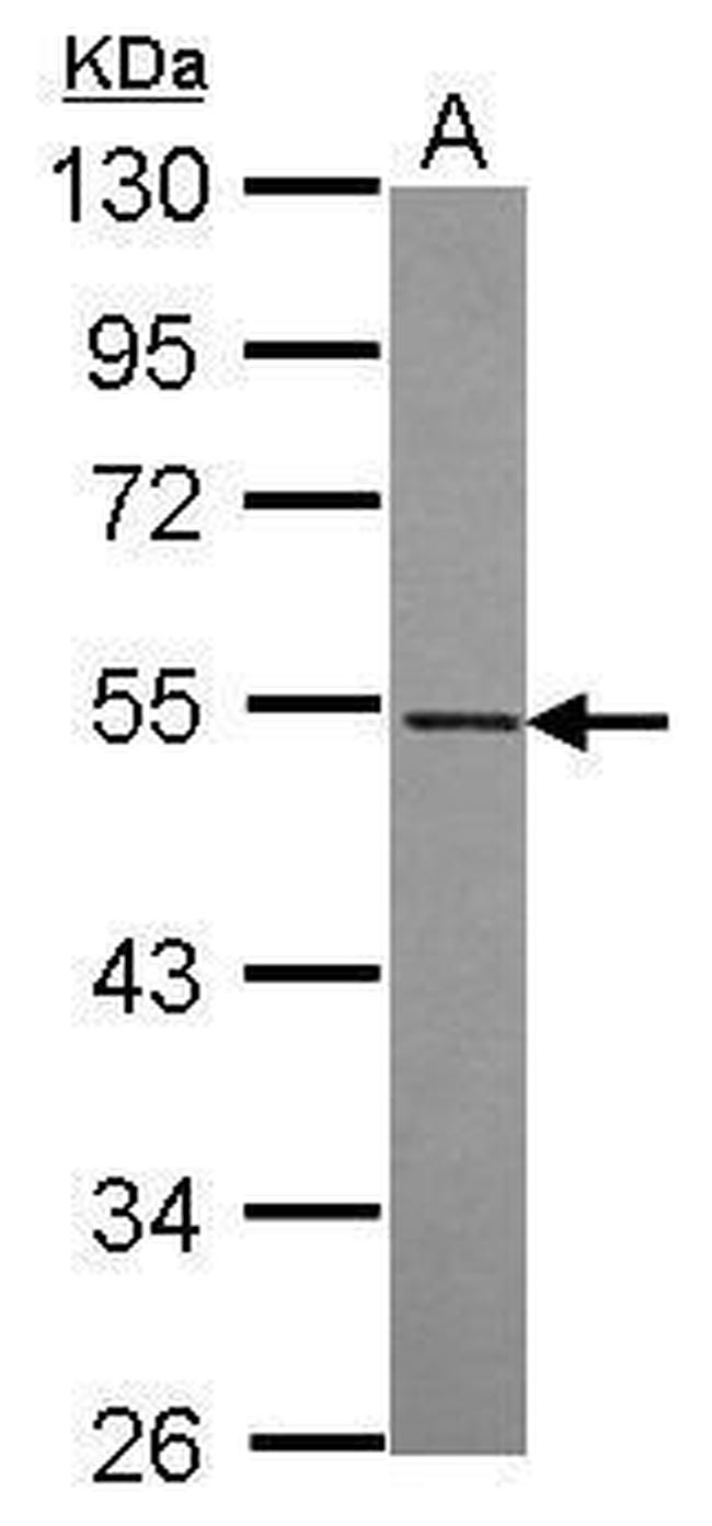 RASGEF1A Antibody in Western Blot (WB)