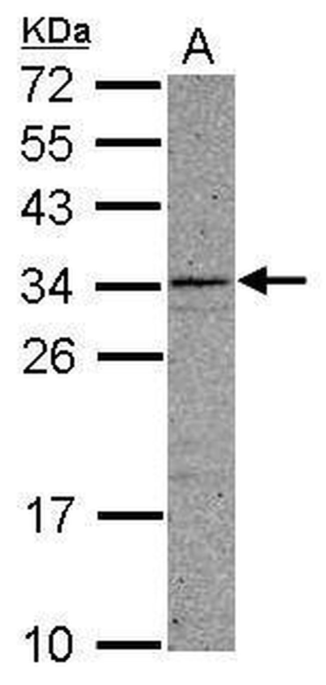CCDC107 Antibody in Western Blot (WB)