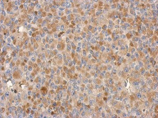 C18orf34 Antibody in Immunohistochemistry (Paraffin) (IHC (P))