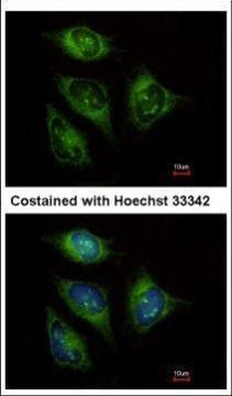 ABCF3 Antibody in Immunocytochemistry (ICC/IF)