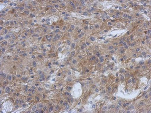 PPFIBP1 Antibody in Immunohistochemistry (Paraffin) (IHC (P))