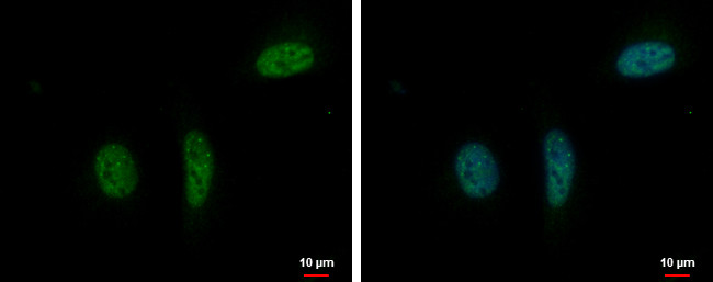 RPRD1B Antibody in Immunocytochemistry (ICC/IF)