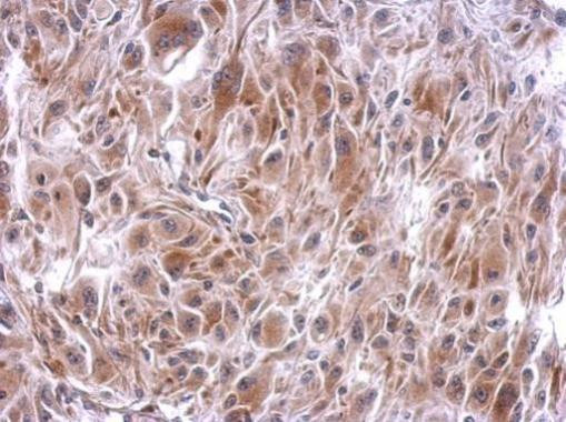 SLFNL1 Antibody in Immunohistochemistry (Paraffin) (IHC (P))