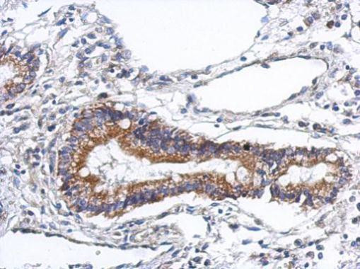 PODN Antibody in Immunohistochemistry (Paraffin) (IHC (P))