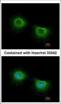 ST3GAL3 Antibody in Immunocytochemistry (ICC/IF)
