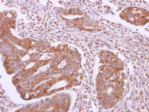 SH3GLB2 Antibody in Immunohistochemistry (Paraffin) (IHC (P))