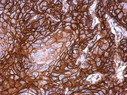 KLHDC5 Antibody in Immunohistochemistry (Paraffin) (IHC (P))