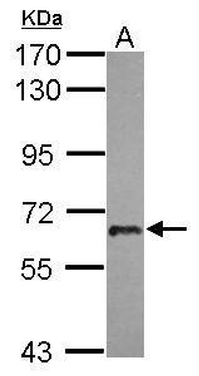 USP22 Antibody in Western Blot (WB)