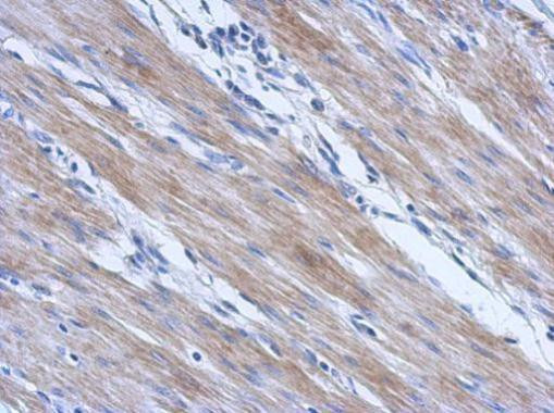 CCDC17 Antibody in Immunohistochemistry (Paraffin) (IHC (P))