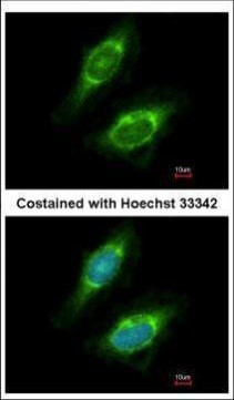 CKAP4 Antibody in Immunocytochemistry (ICC/IF)